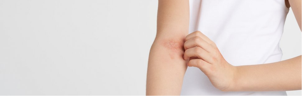How To Manage Itchy Allergy Prone Skin